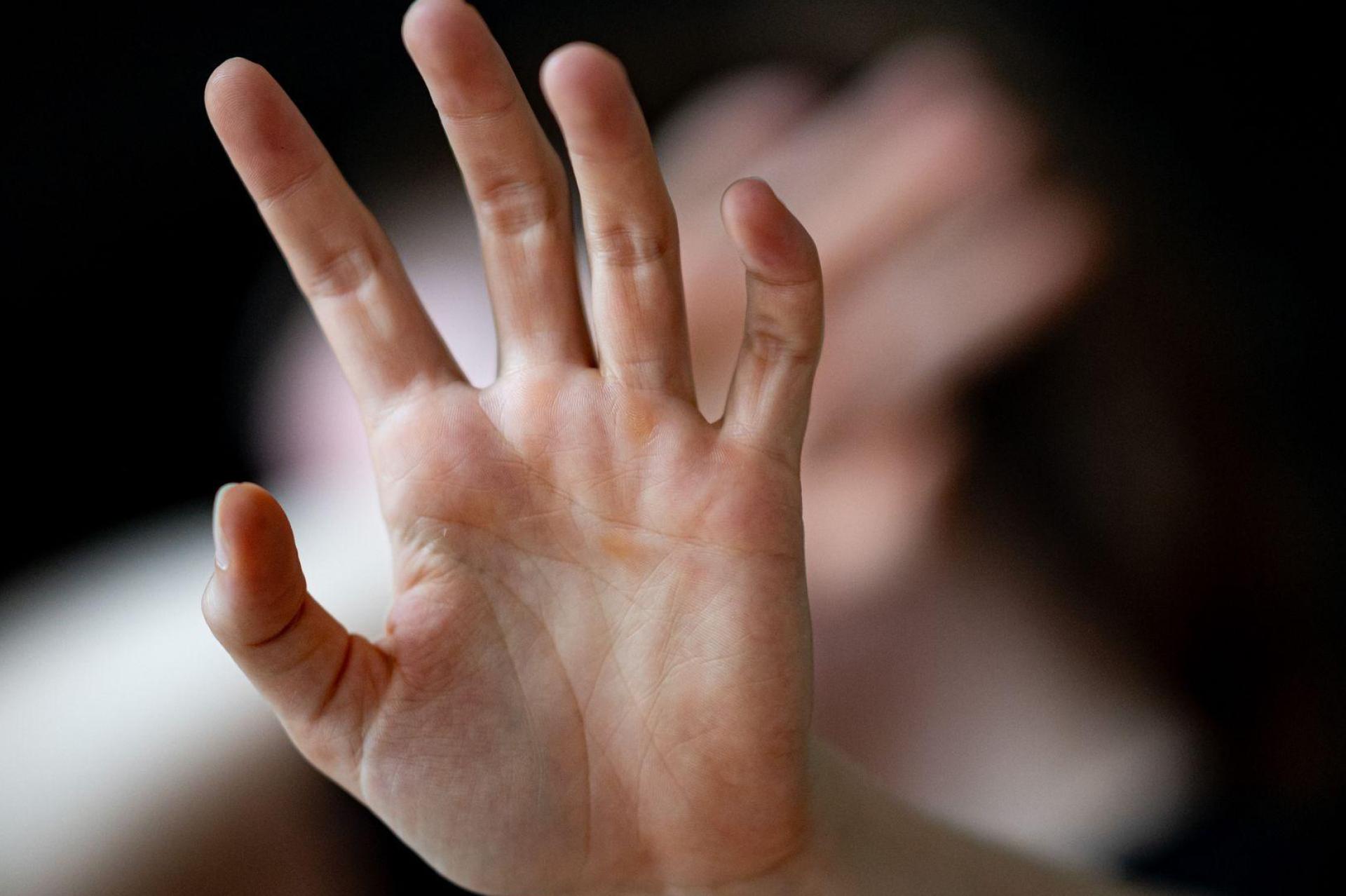 Viele junge Menschen haben laut einer Befragung schon einmal sexualisierte Gewalt erfahren. (Symbolbild) (Bild: Fabian Sommer/dpa)